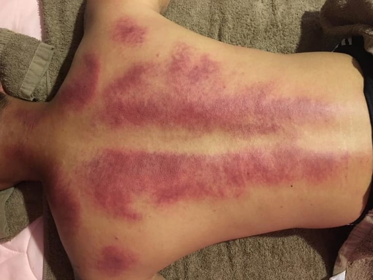 117317251 300270344646311 6517901426412735532 n 768x576