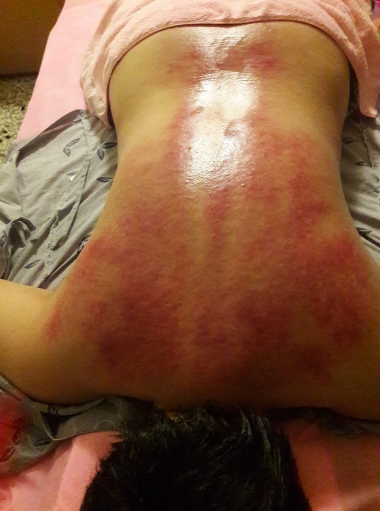 19453081 1782872185338091 2183227570903310396 o 768x1032