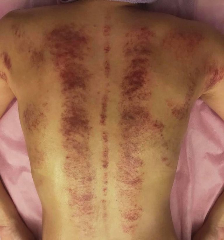 68818412 402976747002018 366962667195203584 n 768x825