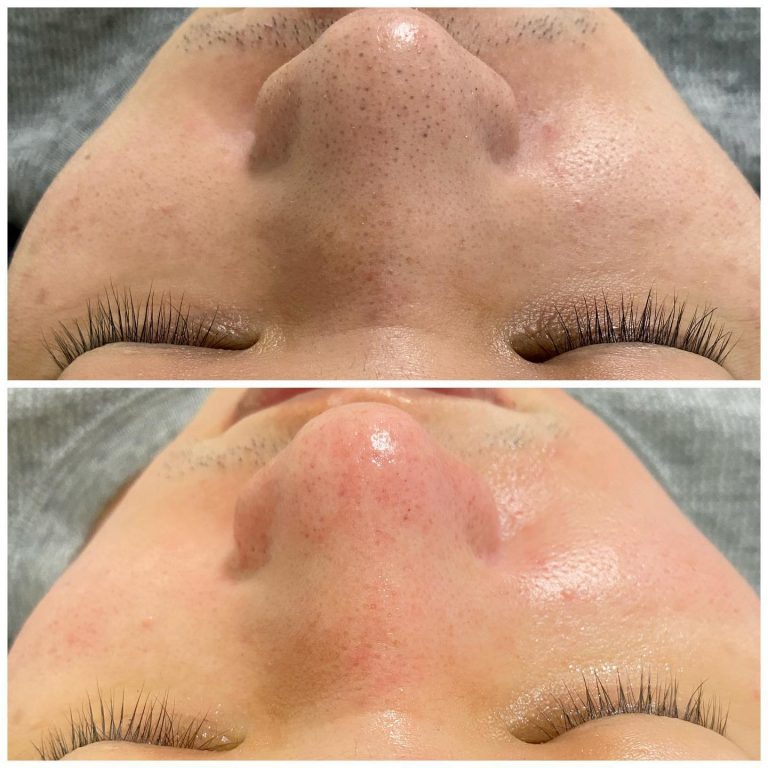 DREAM SPA 日式の美肌社8445 n 768x768