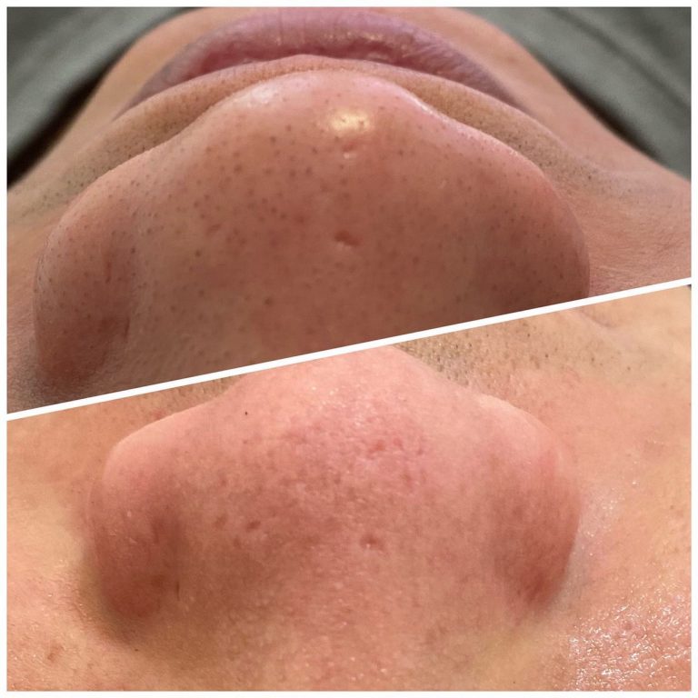 DREAM SPA 日式の美肌社92 n 768x768